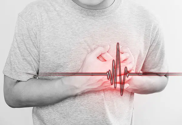 Heart Attack and Stroke Misdiagnosis Attorneys