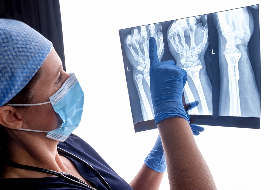 A Misdiagnosed Bone Fracture Can Be Medical Malpractice in Florida