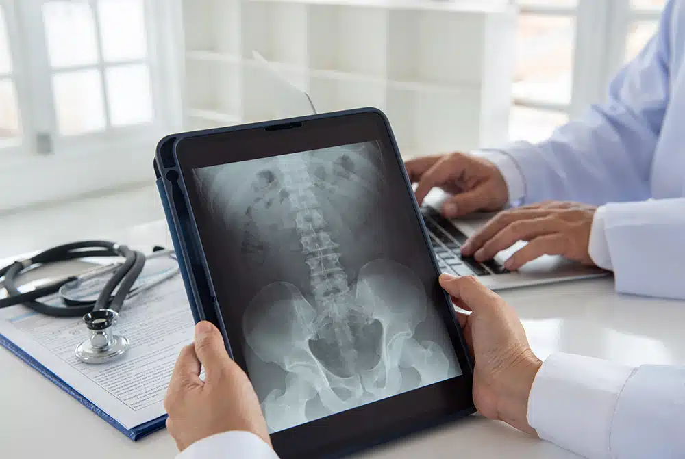 Is Failing to Diagnose and Treat a Spinal Infection Medical Malpractice in Florida?