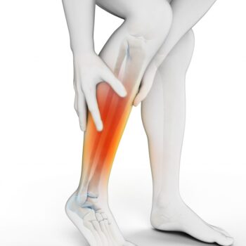 compartment syndrome